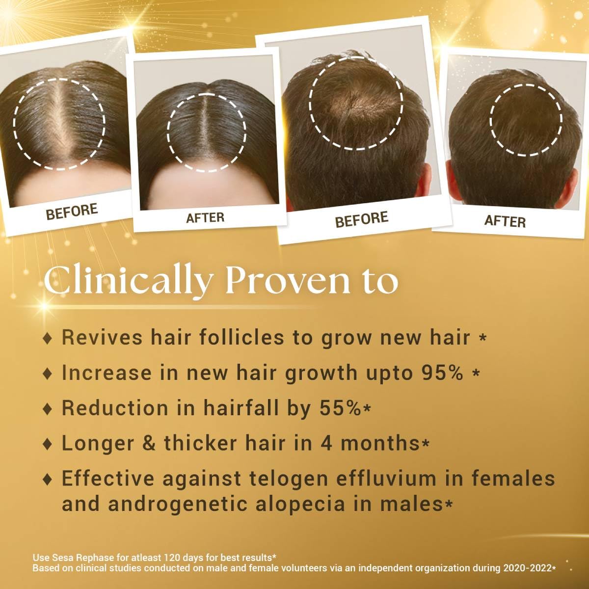SESA Ayurvedic Rephase Refill Hair Growth Oil With 26 Herbs And 6 Essential Oils Promotes Hair Growth Help Reduces Hair Fall & Strengthen Roots Natural Hair Oil For Women And Men, 100 Ml