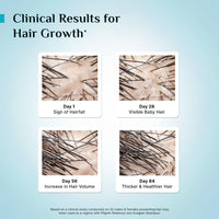 Pilgrim Redensyl 3% + Anagain 4% + Baicapil Advanced Hair Growth Serum (30ml) for Scalp with Korean Black Rice, Saw Palmetto | Control Hair Fall, Stimulate Hair Regrowth, Increase Hair Density | For Women & Men