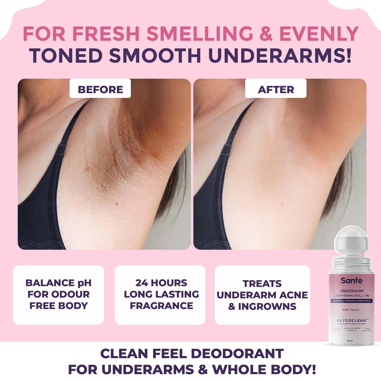 Sanfe Underarm Lightening Roll On (Soft Touch) with 5% AHA Glycolic Acid & Salicylic acid 0.5% W/W For Underarms | Lightens & Remove Pigmentation | Deodorant for Underarms | Glycoclear Technology | Men & Women