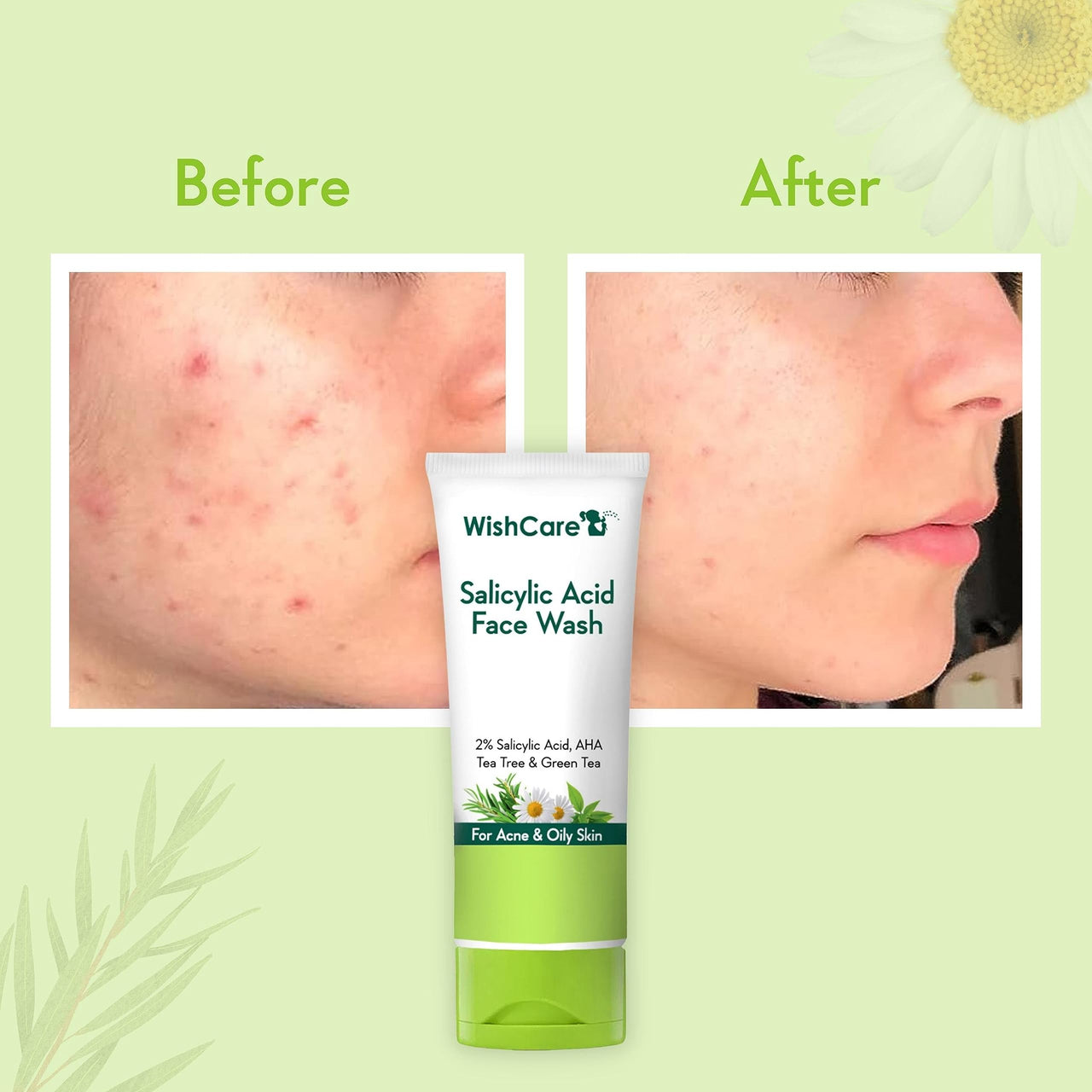 WishCare 2% Salicylic Acid Face Wash for Women & Men with AHA, GreenTea, Chamomile & TeaTree - Face Wash for Oily Skin & Acne Prone Skin 100ml