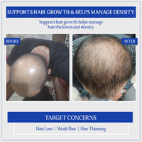TYC - TRUST YOUR CHOICE Herbal Hair Growth Serum with 3% Redensyl, 1% Procapil & 1% Capilia Longa | Manages Hair Fall, Thinning & Loss | Encourages Hair Growth | pH 5.5, 50 ml