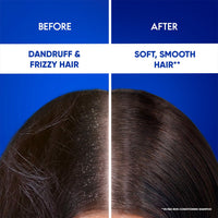 Head & Shoulders 2-in-1 Smooth and Silky Anti Dandruff Shampoo + Conditioner for Women & Men, With Almond Milk (180 ml)