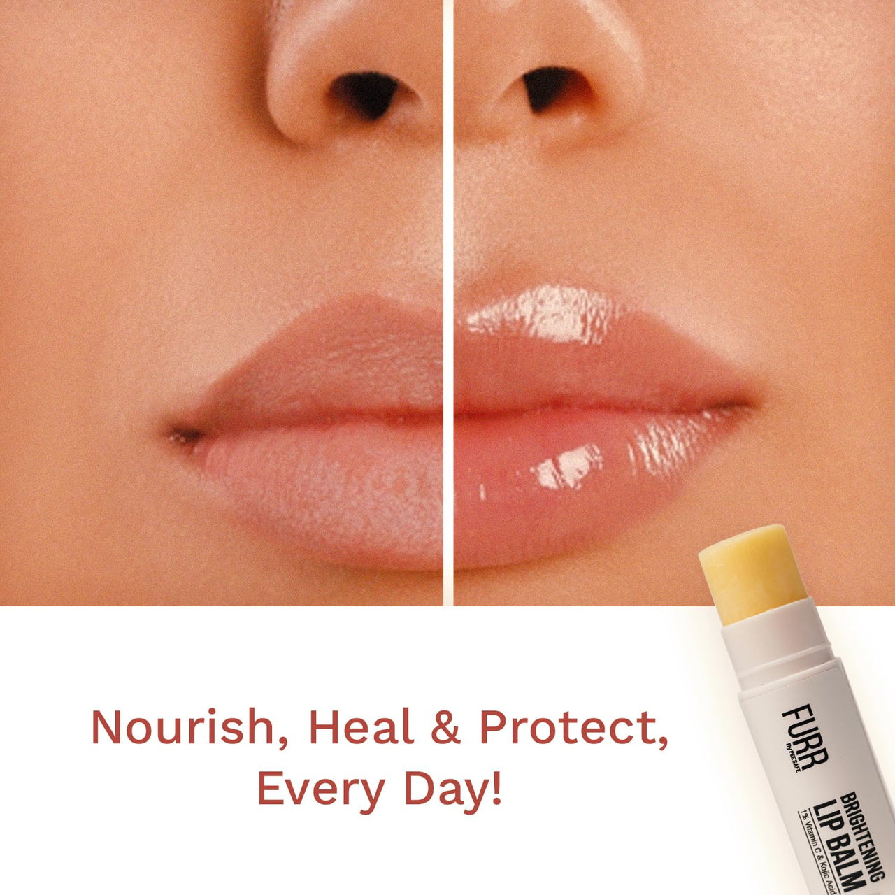 FURR 1% Vitamin C & Kojic Acid Brightening Lip Balm with SPF 30 | Heals, Hydrates & Softens | Reduces Pigmentation | Almond Oil, Shea Butter, Vitamin E Infused | Lip Balm for Soft Glossy Lips | Unisex