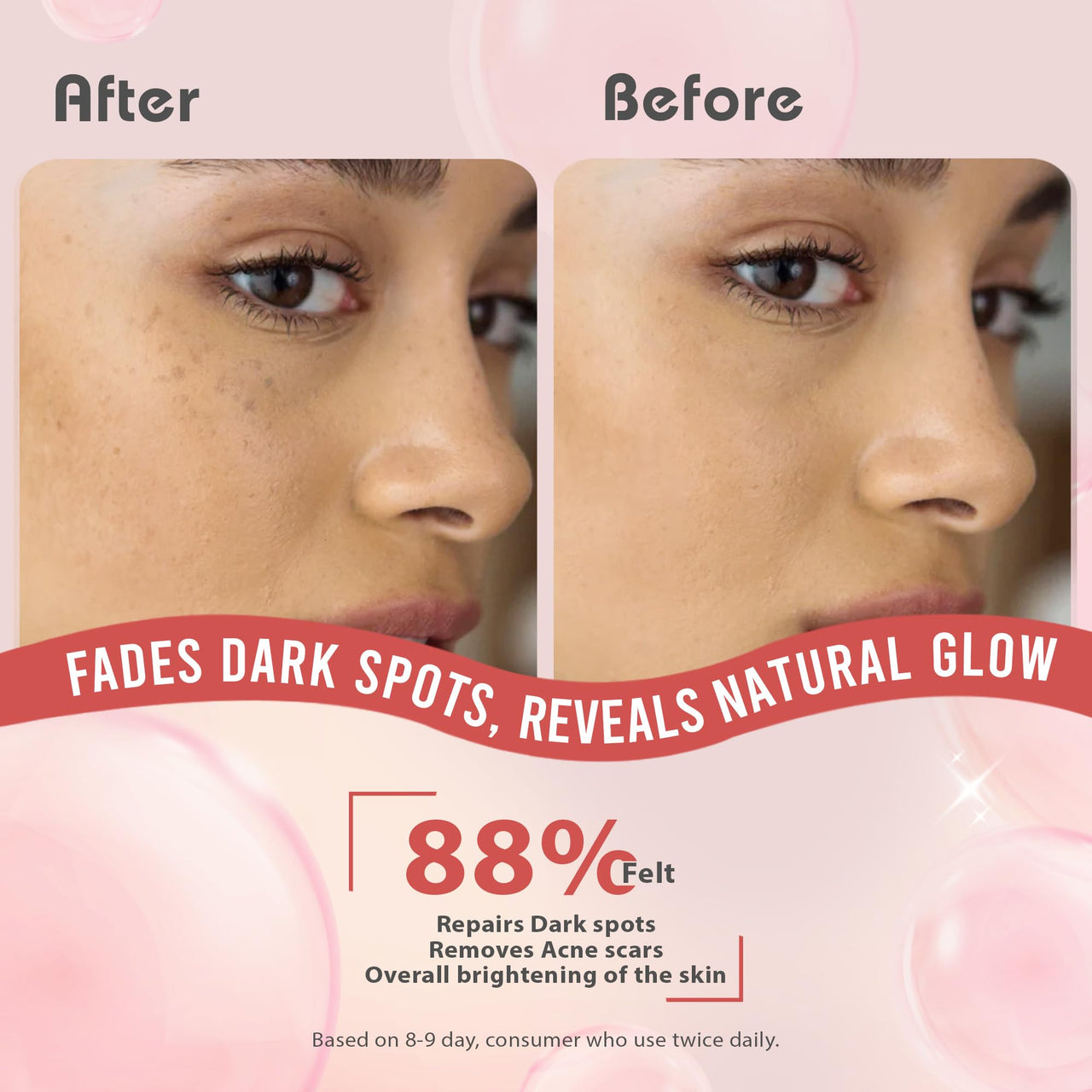 Glamveda 2% Kojic Acid Face Serum with Niacinamide & Alpha Arbutin | Skin Brightening & Hydration | Dark Spot, Blemish & Wrinkle Reduction | Glass Skin Glow | All Skin Types