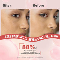 Glamveda 2% Kojic Acid Face Serum with Niacinamide & Alpha Arbutin | Skin Brightening & Hydration | Dark Spot, Blemish & Wrinkle Reduction | Glass Skin Glow | All Skin Types