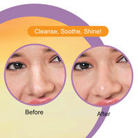 DR.RASHEL Vitamin C Nose Strip With Hazel Extracts Observes Dirt And Oil (10 Strips &10 Wipes)