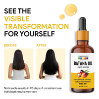 Organix Mantra Batana Oil for Hair & Skin | 100% Pure, Unrefined, Cold Pressed Oil from Honduras | Promotes Hair Growth, Nourishes Scalp & Skin | Natural Moisturizer – 30ML