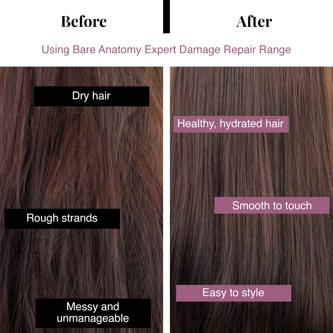 Bare Anatomy Ultra Smoothing Shampoo for Dry and Frizzy Hair | Restores Smoothing & Texture by 37% | Powered By Carbohydrate Complex & Niacinamide | SLS & Paraben Free | Vegan | For Men & Women -250ml