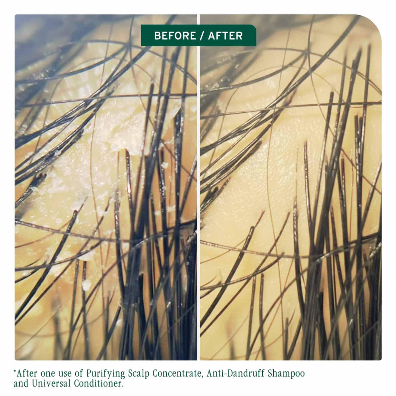 Biolage ScalpSync Concentrate –Scalp Exfoliating & Purifying Treatment, Clarifies Build-Up & Balances Scalp for upto 72hrs-With Fermented Tea Blend & Glycolic Acid, 200ml