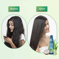 Parachute Advansed Aloe Vera Enriched Coconut Hair Oil, 250ml (Free 75ml) & For Soft & Strong Hair, 400 ml