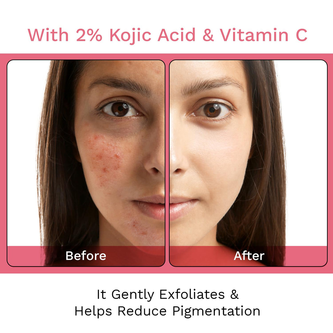 FURR 2% Kojic Acid Soap with Glutathione & Alpha-Arbutin | Cherry Blossom Extract | Reduces Pigmentation | Gently Exfoliates | Unisex | Suitable For All Skin Types | 75g (Pack of 2)