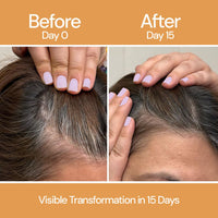 CITTA Hair Growth Serum | Boosts Hair Growth, Activates Follicles & Prevents Thinning | Biotin, Rosemary & Fenugreek Oil | Nourishes Scalp & Increases Hair Vitality | For All Hair Types | 50ml