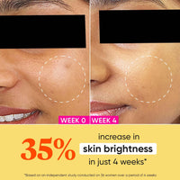 Dot & Key Vitamin C + E Sorbet Super Bright Moisturizer for Face | Vitamin C Face Cream For Glowing Skin | Reduces Skin Dullness | Oil Free & Lightweight | For All Skin Types | 25ml