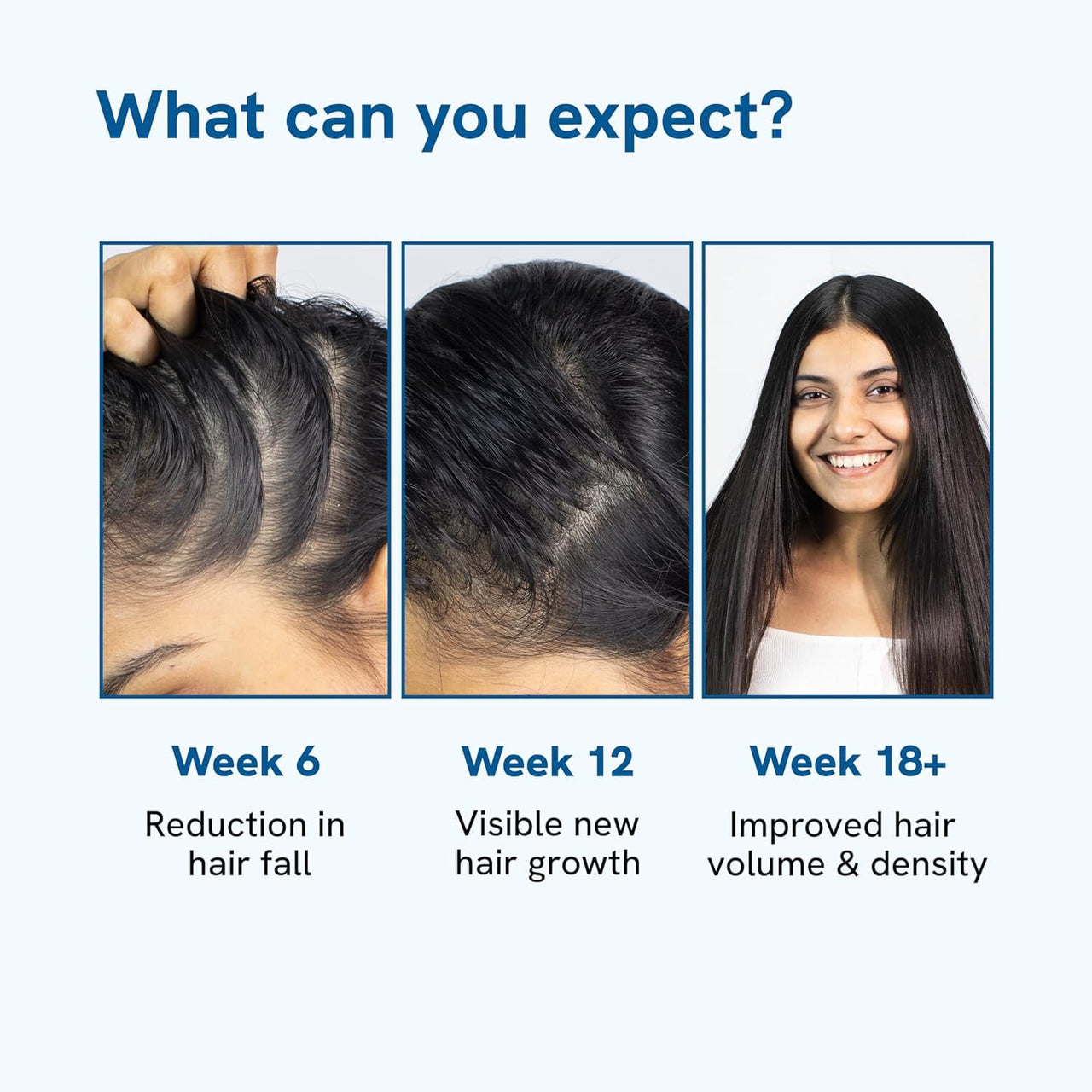 Be Bodywise Rosemary Hair Growth Serum (Roll On) | Promotes Hair Growth & Stimulates Hair Follicles | 3% Rosemary, 3% Redensyl & 2% Anagain | Hair fall control serum for Women & Men | For All Hair Types | 50ml