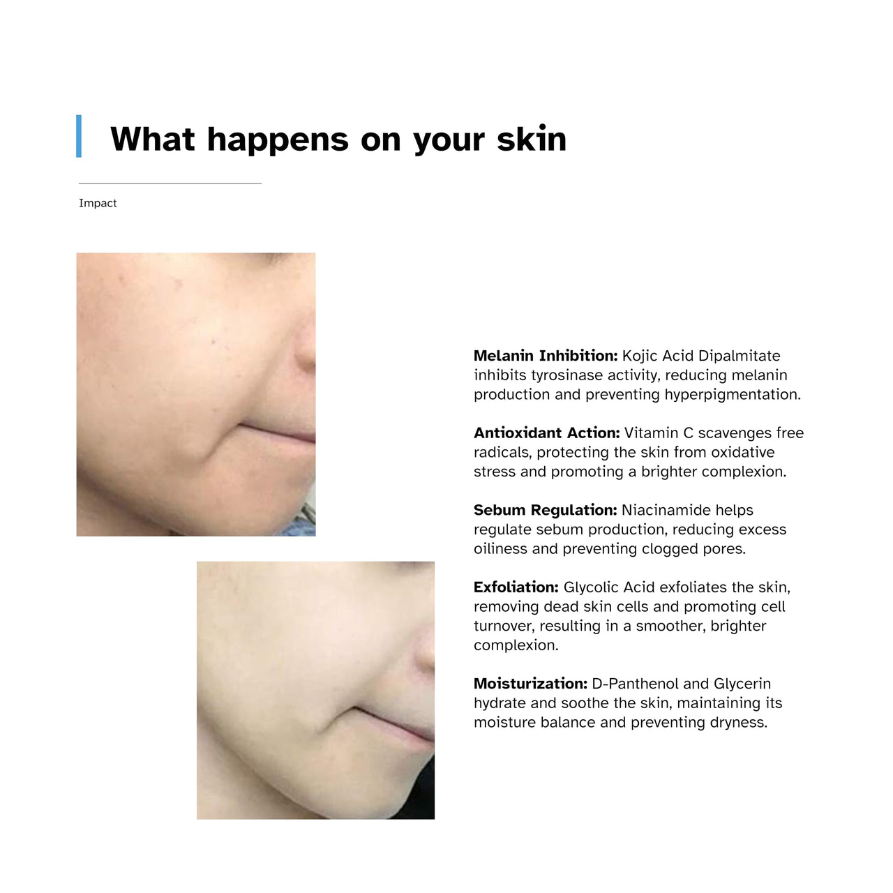Aecxo Glo 2% Kojic Acid Brightening Face Wash With 1% Glycolic Acid, 3% Niacinamide & Vitamin C | Fights Tanning, Dark Spots & Pigmentation | Good For All Skin Types (70ml)