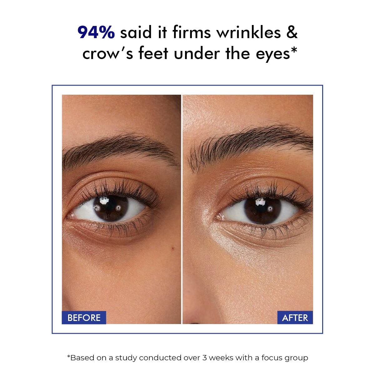Conscious Chemist® Retinol Peptide Under Eye Cream With Soothing Massage Roller | Under Eye Roll On For Dark Circles, Fine Lines & Puffy Eyes | For Women & Men | 15 ml
