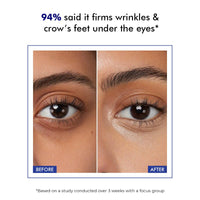 Conscious Chemist® Retinol Peptide Under Eye Cream With Soothing Massage Roller | Under Eye Roll On For Dark Circles, Fine Lines & Puffy Eyes | For Women & Men | 15 ml
