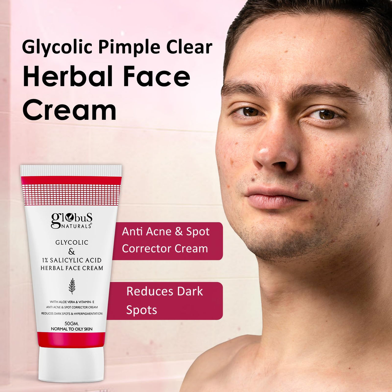 Globus Naturals Glycolic & 1% Salicylic Acid Herbal Anti Acne Face Cream, Enriched with Aloe Vera & Vitamin E, Reduces Dark spots & Hyperpigmentation, 50gm