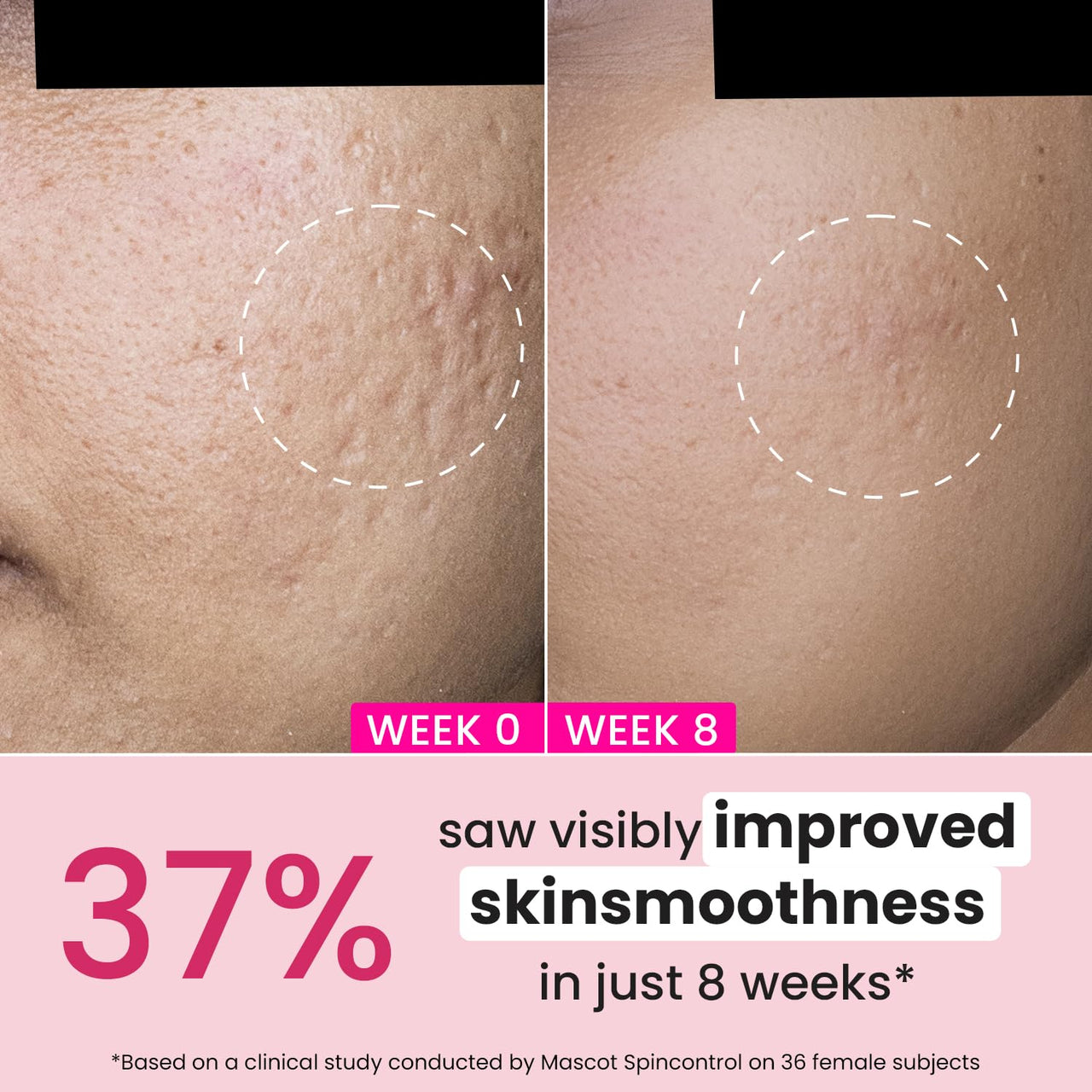 Dot & Key Night Reset Retinol + Ceramide Night Cream | Anti Aging Cream For Women & Men | Reduces Fine Lines & Wrinkles | Oil Free & Non Sticky Moisturizer | For Glowing Youthful Skin | For All Skin Types | 60ml