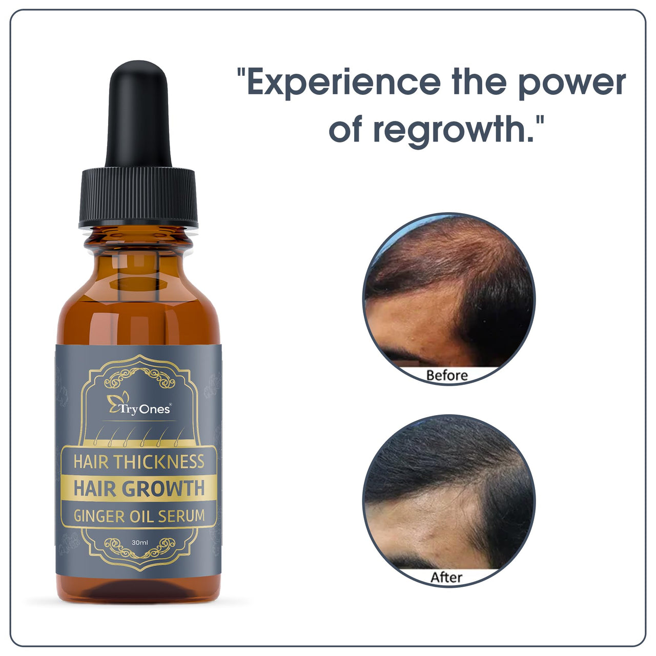 TryOnes Professional Hair Serum for Frizzy Hair||Serum for Women & Men||All Hair Types for Frizz-free, Smooth & Glossy Hair||Hair Growth Ginger Oil Serum_30ML