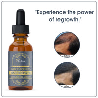 TryOnes Professional Hair Serum for Frizzy Hair||Serum for Women & Men||All Hair Types for Frizz-free, Smooth & Glossy Hair||Hair Growth Ginger Oil Serum_30ML