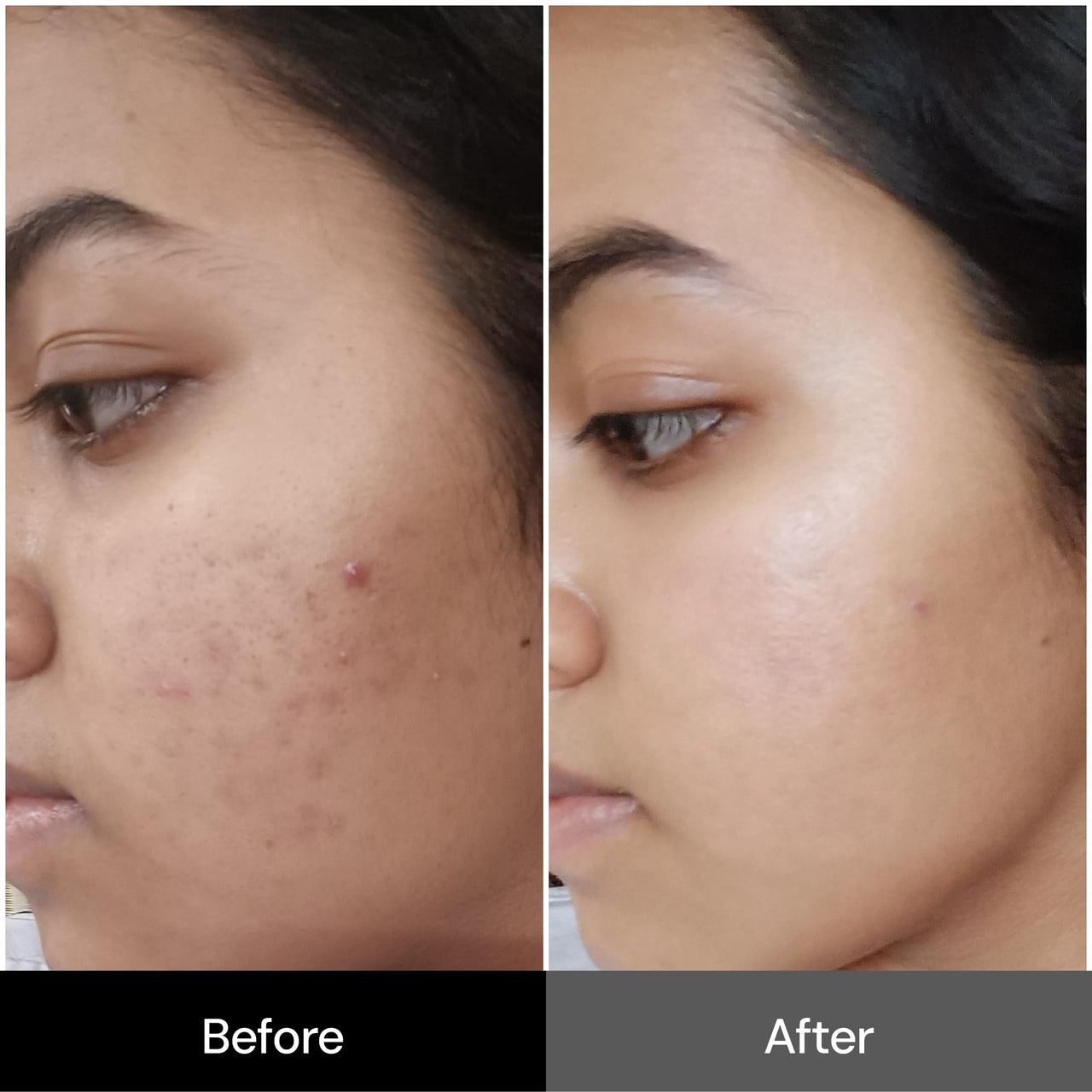 Suganda Skincare Advanced Pigmentation Face Serum (30ml) - Brightening Serum for Dark Spots, Even Skin Tone, for Men & Women, All Skin Types