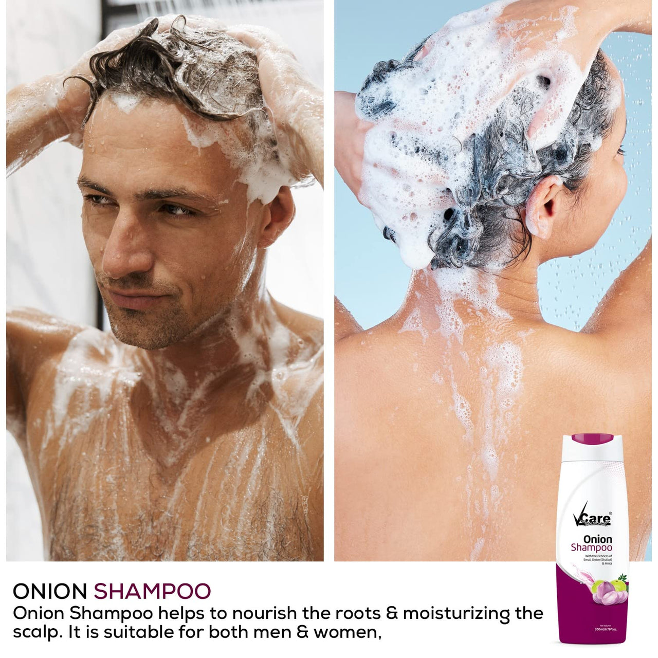 VCare Small Onion Shampoo for Hair Growth 200ml and Hair Fall Control - With Shallot Onion and Amla Suitable for Both Men & Women (Pack Of 4)