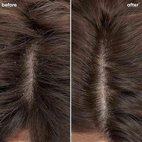 Biolage Professional Scalppure Anti-Dandruff Hair Serum, Removes Visible Flakes from 1st Use, Enriched with Bergamot, Hair Serum for Men and Women, Deep Scalp Treatment, Cruelty-Free, 100 ml