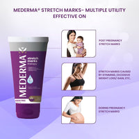 Mederma Stretch Marks Therapy | Stretch Mark Cream For Women & Men | Anti stretch mark cream during & After pregnancy (50g)