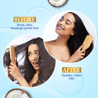 Parachute Advansed Gold Biotin & Coconut Hair Oil | Deep Nourishment for Fuller Hair| No Paraben or Silicone | 300ml