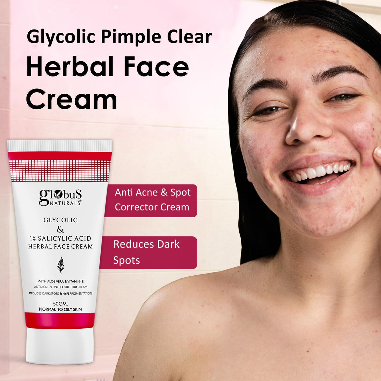 Globus Naturals Glycolic & 1% Salicylic Acid Herbal Anti Acne Face Cream, Enriched with Aloe Vera & Vitamin E, Reduces Dark spots & Hyperpigmentation, 50gm