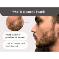 Man Matters Beardmax Growth Serum 30ml | 5% Minoxidil | Activates Beard Follicles | Solves Uneven & Patchy Beard | Alcohol Free