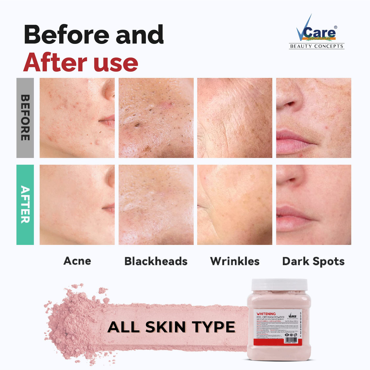 Vcare Jelly Whitening Peel Off Mask For Facials Skincare |Face Mask Powder 250g - Facial Skin Care Product for Women Smoothing, Moisturizing, Cleansing, Refreshing|Suits All Skin Types