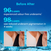 Chemist at Play UnderArm Roll-On with 5% AHA, Lactic Acid & 1% Mandelic Acid | Prevents Body Odour, Brightens Skin & Exfoliates Underarm | Fades Pigmentation & Kills Bacteria | For Sensitive Skin | Aqua Fragrance | Alcohol Free - 75ml