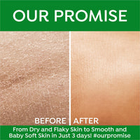 BEE ONE Aloevera Massage Cream 800ml Skin Brightening Moisturizing Day Cream for Men and Women Daily Use Hand and Skin Moisturizer