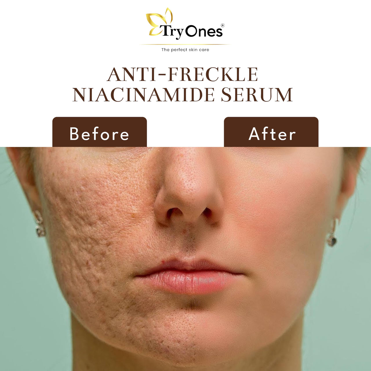 TryOnes Skin Naturals, Bright Complete 30X Vitamin C Booster Face Serum, Increases Skin's Glow Instantly and Reduces Spots Overtime for Men & Women_Anti-Fricle_30ml