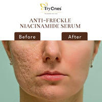 TryOnes Skin Naturals, Bright Complete 30X Vitamin C Booster Face Serum, Increases Skin's Glow Instantly and Reduces Spots Overtime for Men & Women_Anti-Fricle_30ml