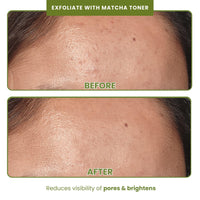 THE SKIN DIET COMPANY Exfoliate + Repair Saver Duo | Matcha Toner & Avocado Serum | Refreshing Exfoliation | Unclogs Pores, Improves Texture, Fades Pigmentation | All Skin Types (100ml + 15ml)