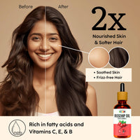 Organix Mantra Rosehip Seed Body Oil for Face Wrinkles, Fine Lines, Under Eye, Curly Hair | 100% Pure, Natural & Cold Pressed Oil, 30ML