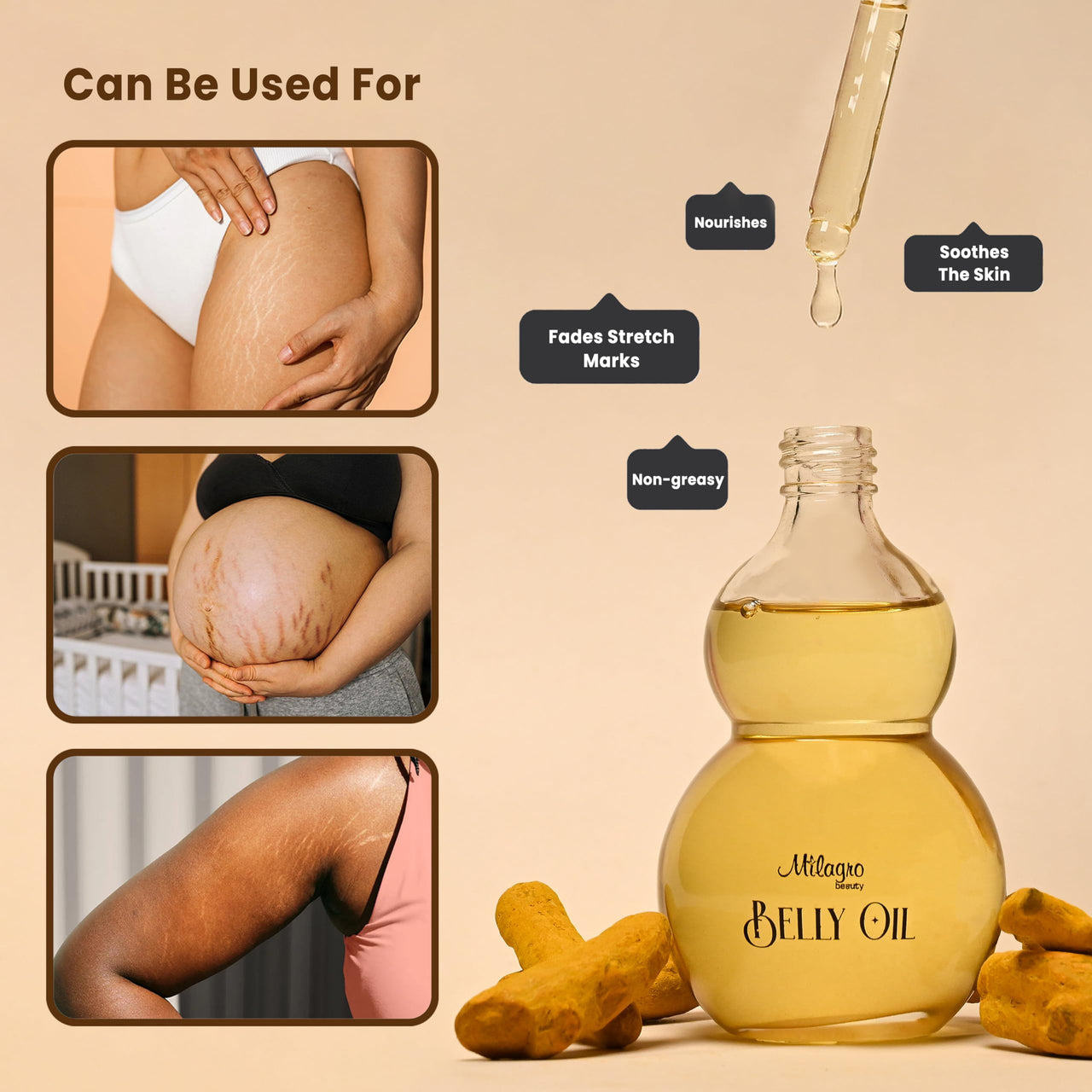 Milagro Beauty Ayurvedic Belly Oil | Stretch Marks Treatment | Scar Removal Oil| Pregnancy And Breastfeeding Safe | Sweet Almond Oil+20 Botanical Ingredients | Fresh And Old Scar Healing | 100Ml