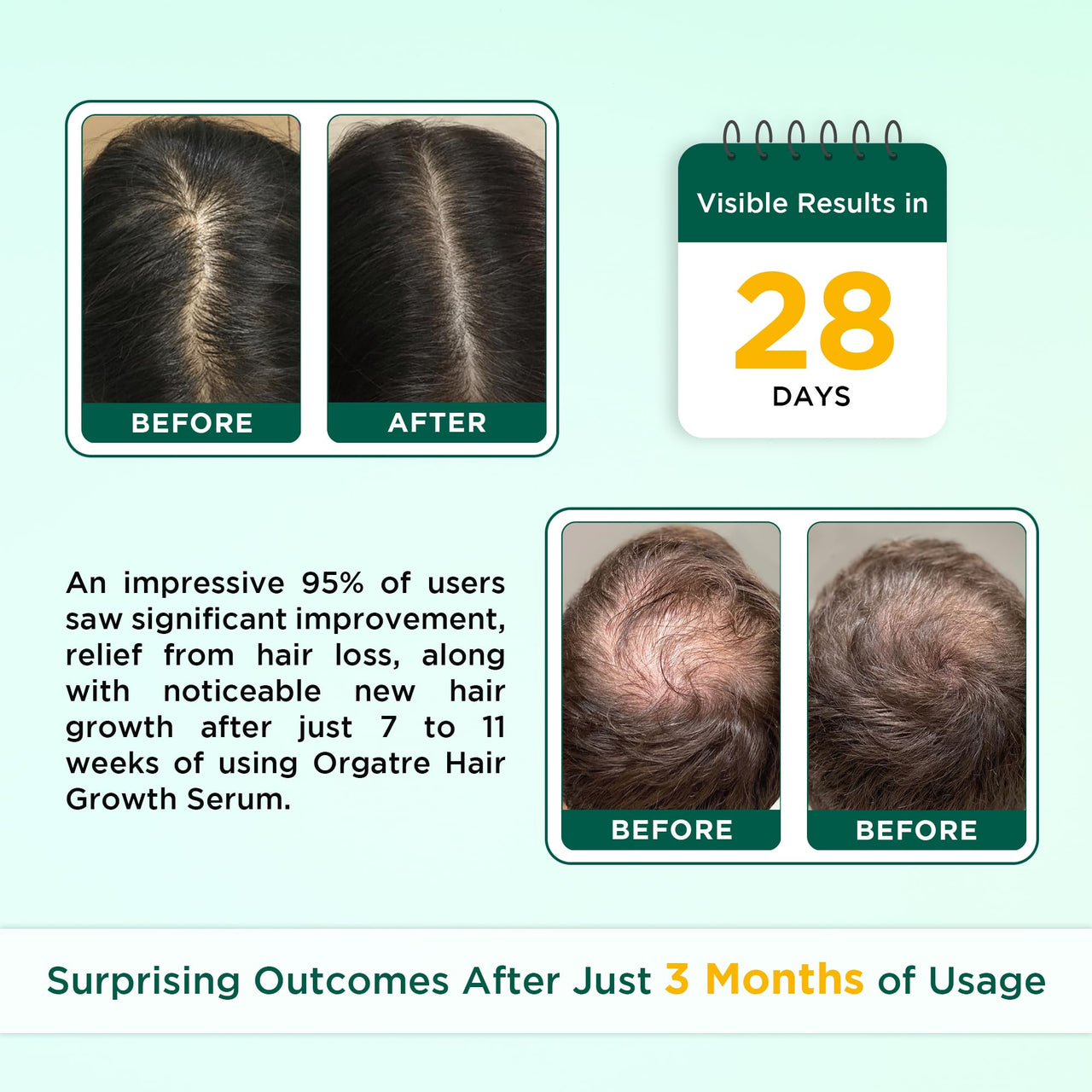 ORGATRE Hair Growth Serum for scalp - 50ml | 3% Redensyl, 4% Anagain, 3% Procapil, 1% Capilia Longa & Rosemary Oil | Scalp Treatment & Hair Tonic for Men & Women | Effective Hair Regrowth Formula