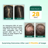 ORGATRE Hair Growth Serum for scalp - 50ml | 3% Redensyl, 4% Anagain, 3% Procapil, 1% Capilia Longa & Rosemary Oil | Scalp Treatment & Hair Tonic for Men & Women | Effective Hair Regrowth Formula