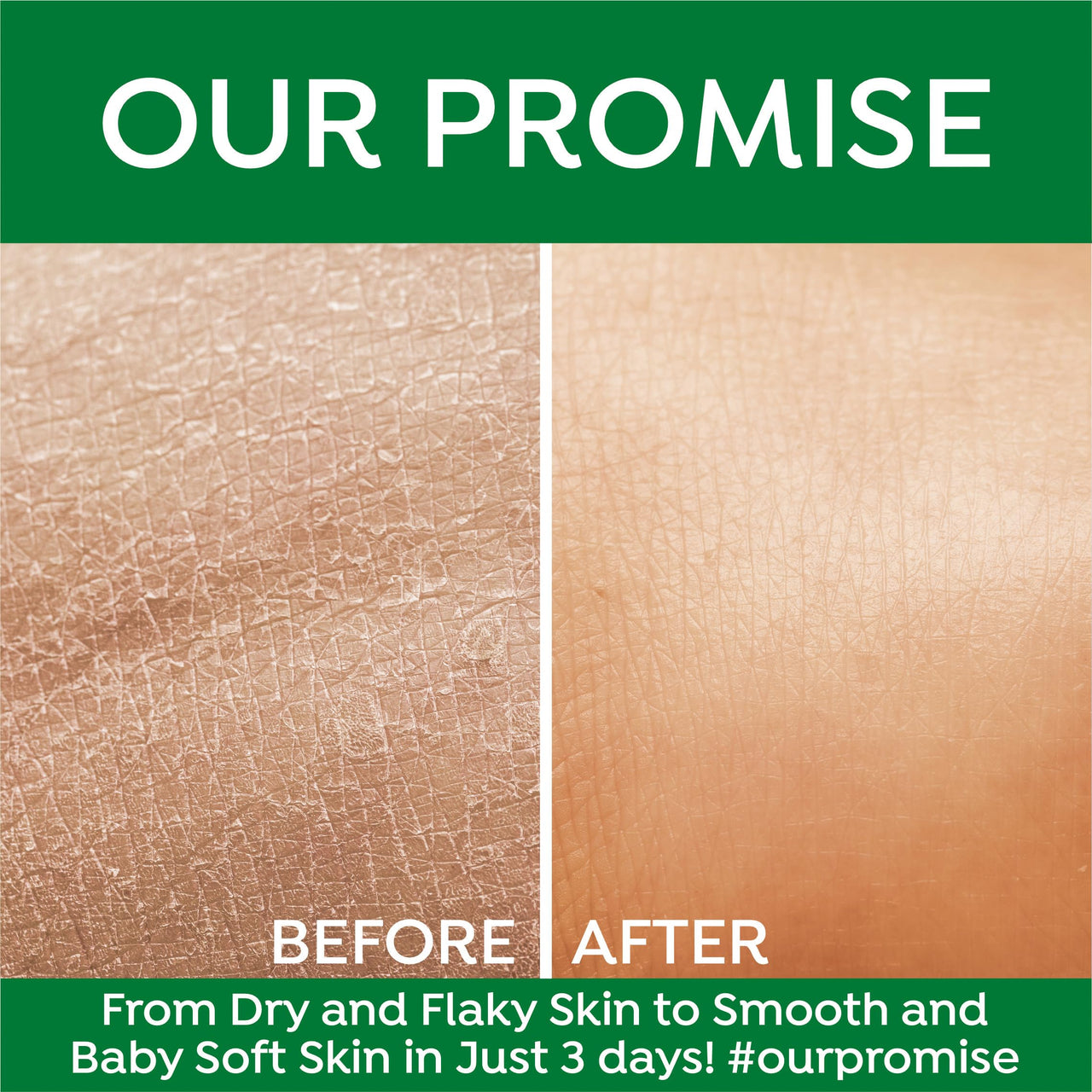 Bee One 24 Hr Aloevera Moisture Lock Body Lotion 1000ml | Hydrating Formula for Soft & Supple Skin, Long-Lasting Moisture & Nourishment | Suitable for all skin types