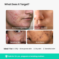 THE SOLVED SKIN India’s 1st Derma Tested Barrier Repair Gel Moisturiser With Lamellar Liquid Technology Reverses 4 Signs of Skin Damage by 70% Within 4 Weeks. 48 Hours Hydration. 50ml