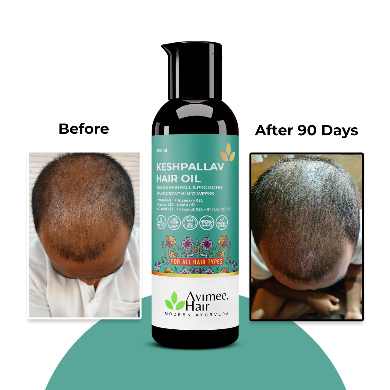 Avimee Herbal Keshpallav Hair Oil For Men & Women | Promotes Hair Growth & Reduces Hair Fall | With Rosemary, Castor, Amla, Coconut and Bhringraj Oil | Mineral Oil Free (Pack of 3)