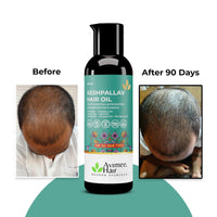 Avimee Herbal Keshpallav Hair Oil For Men & Women | Promotes Hair Growth & Reduces Hair Fall | With Rosemary, Castor, Amla, Coconut and Bhringraj Oil | Mineral Oil Free (Pack of 3)