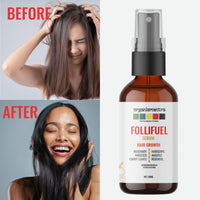 Organix Mantra FolliFuel Hair Growth Serum with Anageline, Hairgenyl, Redensyl, Rosemary, Hibiscus & Curry Leaves | Promotes Hair Growth, Strengthens Roots, Nourishes Scalp - 30ML