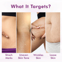Conscious Chemist® Retinol Body Cream | Reduces Stretch Marks, Uneven Skin Tone & Scars | For Post Pregnancy Irregular Lines/Streaks | All Skin Types, Fragrance Free & Cruelty Free | 100 g