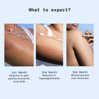Be Bodywise Pigmentation Cream 100gm | 2.5% Lactic Acid, 2% Urea, Retinol & Kojic Acid | Reduces Tan, Pigmentation & Evens Skin Tone | Treats Dark Patches & Rough Skin on Elbows, Knees, Back of Neck & Thighs | For Daily Use