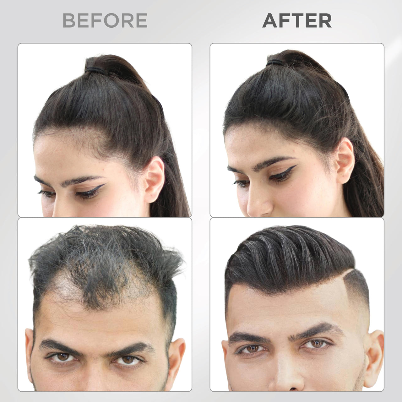 THICK FIBER - Fibers for Thinning Hair & Bald Spots (BLACK, Pack of 2) - 25g Bottle - Conceals Hair Loss in Seconds for Women & Men